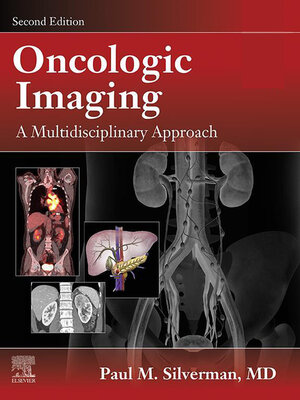 cover image of Oncologic Imaging